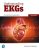 Understanding EKGs A Practical Approach 5th Edition Brenda M. Beasley